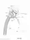 Fig. 24 - Positioning and stabilising structure and patient interface