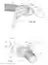Fig. 29 - Positioning and stabilising structure and patient interface