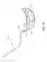Fig. 33 - Positioning and stabilising structure and patient interface
