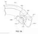 Fig. 35 - Positioning and stabilising structure and patient interface