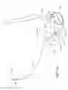 Fig. 46 - Positioning and stabilising structure and patient interface