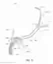 Fig. 62 - Positioning and stabilising structure and patient interface