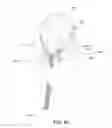 Fig. 74 - Positioning and stabilising structure and patient interface