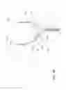 Fig. 84 - Positioning and stabilising structure and patient interface