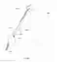 Fig. 87 - Positioning and stabilising structure and patient interface
