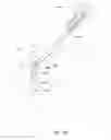 Fig. 89 - Positioning and stabilising structure and patient interface