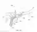 Fig. 95 - Positioning and stabilising structure and patient interface