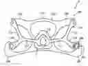 Fig. 01 - Patient interface device and retention assembly therefor