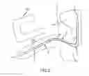Fig. 04 - Catheters and catheter mating devices and systems