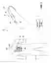 Fig. 02 - Medical device sensor