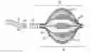 Fig. 01 - Double balloon catheter having a lobed inner balloon