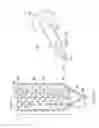 Fig. 03 - Apparatus for negative-pressure therapy and irrigation