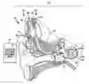Fig. 01 - Recipient-directed electrode set selection