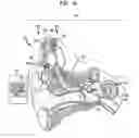 Fig. 02 - Recipient-directed electrode set selection