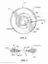 Fig. 07 - Electrostimulation to increase perfusion