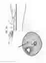 Fig. 09 - Implant and delivery tool therefor