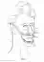 Fig. 02 - METHOD AND APPARATUS FOR TOOTH REGULATION WITH HEAVY FORCES