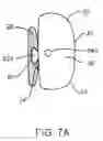 Fig. 08 - METHOD AND APPARATUS FOR TOOTH REGULATION WITH HEAVY FORCES