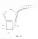 Fig. 22 - METHOD AND APPARATUS FOR TOOTH REGULATION WITH HEAVY FORCES