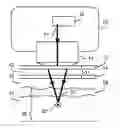 Fig. 01 - Device for light based skin treatment