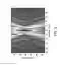 Fig. 04 - Systems and methods for modulation and mapping of brain tissue using an ultrasound assembly