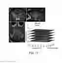 Fig. 12 - Systems and methods for modulation and mapping of brain tissue using an ultrasound assembly