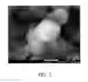 Fig. 02 - Composition for preventing or treating dentin-associated symptoms or diseases, and method using the same