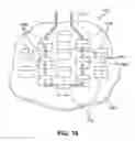 Fig. 19 - Article of apparel with dynamic padding system