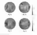 Fig. 06 - Exchange column distributor tray comprising a dispersive material within a chimney for gas passage