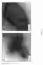 Fig. 14 - NANO SEEDING TOOLS TO GENERATE NANOMETER SIZE CRYSTALLIZATION SEEDS