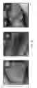 Fig. 26 - NANO SEEDING TOOLS TO GENERATE NANOMETER SIZE CRYSTALLIZATION SEEDS