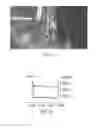 Fig. 13 - Air filter condition sensing