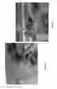 Fig. 05 - Acoustic wave microfluidic devices with increased acoustic wave energy utilisation