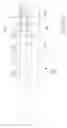 Fig. 14 - FLOATING JAW ASSEMBLY FOR USE WITH MACHINIST VISES