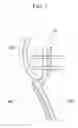 Fig. 02 - Method that forms pattern on fabric member and fixes pattern on trim