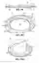 Fig. 12 - Wheel hub and bearing assembly packaging