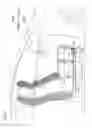 Fig. 04 - Vehicle slide rail device