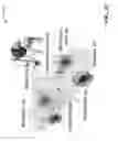 Fig. 04 - Facilitation of automatic adjustment of a braking system