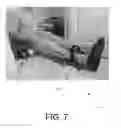 Fig. 08 - Hoverboard buddy system