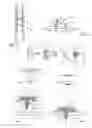 Fig. 02 - Self-perforating spacer for an insulation blanket of an aircraft, assembly method for said spacer and insulation blanket for an aircraft fitted with said spacer
