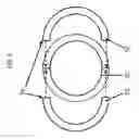 Fig. 05 - Propulsor hub weight element and balancing method