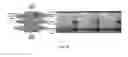 Fig. 40 - Ion concentration polarization-electrocoagulation hybrid water treatment system