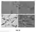 Fig. 84 - SOLID FORMS OF A BET INHIBITOR