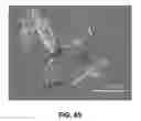 Fig. 86 - SOLID FORMS OF A BET INHIBITOR
