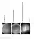 Fig. 02 - S1PR2 ANTAGONISTS AND USES THEREFOR