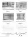 Fig. 03 - Truncated rotavirus VP4 protein and application thereof