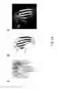 Fig. 15 - IMMUNOGENIC COMPOSITION COMPRISING ENGINEERED ALPHA-HEMOLYSIN OLIGOPEPTIDES