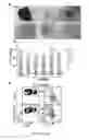 Fig. 57 - Cells lacking B2M surface expression and methods for allogeneic administration of such cells