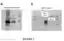 Fig. 03 - INHIBITION OF THE SYNTHESIS OF BETA-APP OR OF THE ACTIVITY OF THE A-BETA PEPTIDE IN THE CHOROID PLEXUS