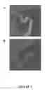 Fig. 04 - INHIBITION OF THE SYNTHESIS OF BETA-APP OR OF THE ACTIVITY OF THE A-BETA PEPTIDE IN THE CHOROID PLEXUS